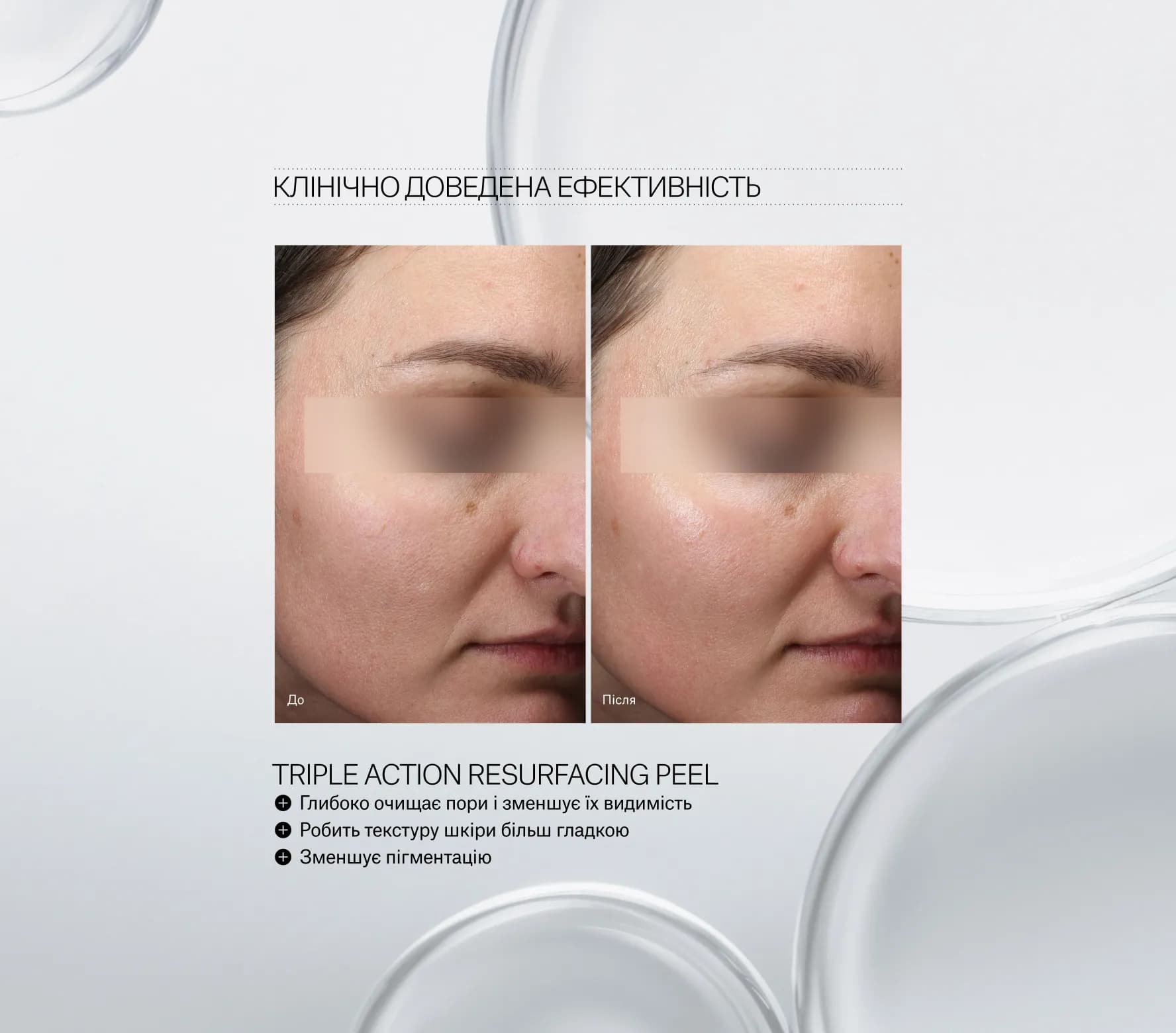 Triple Action Resurfacing Peel Next-Gen