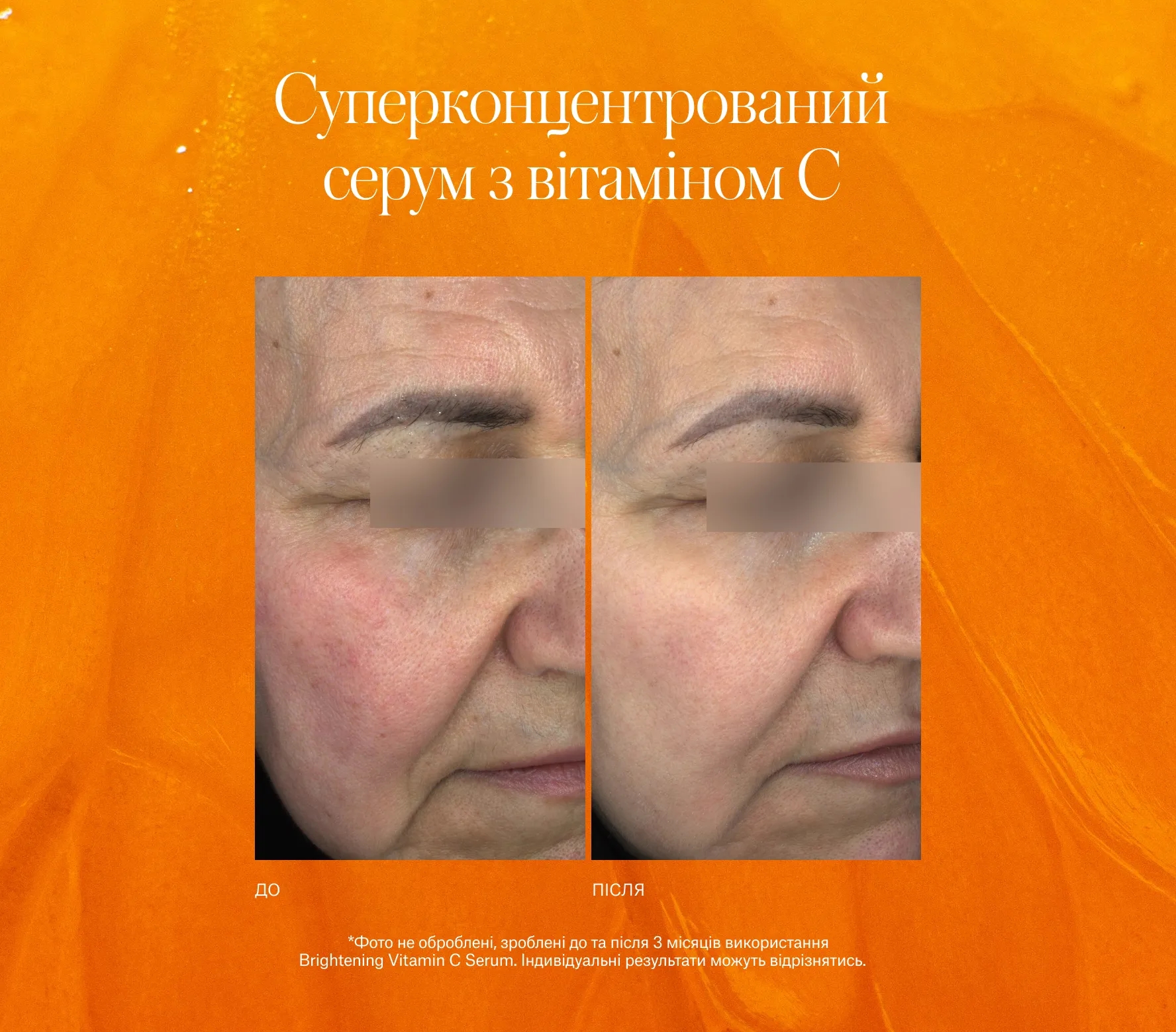 Brightening Vitamin C Serum Next-Gen