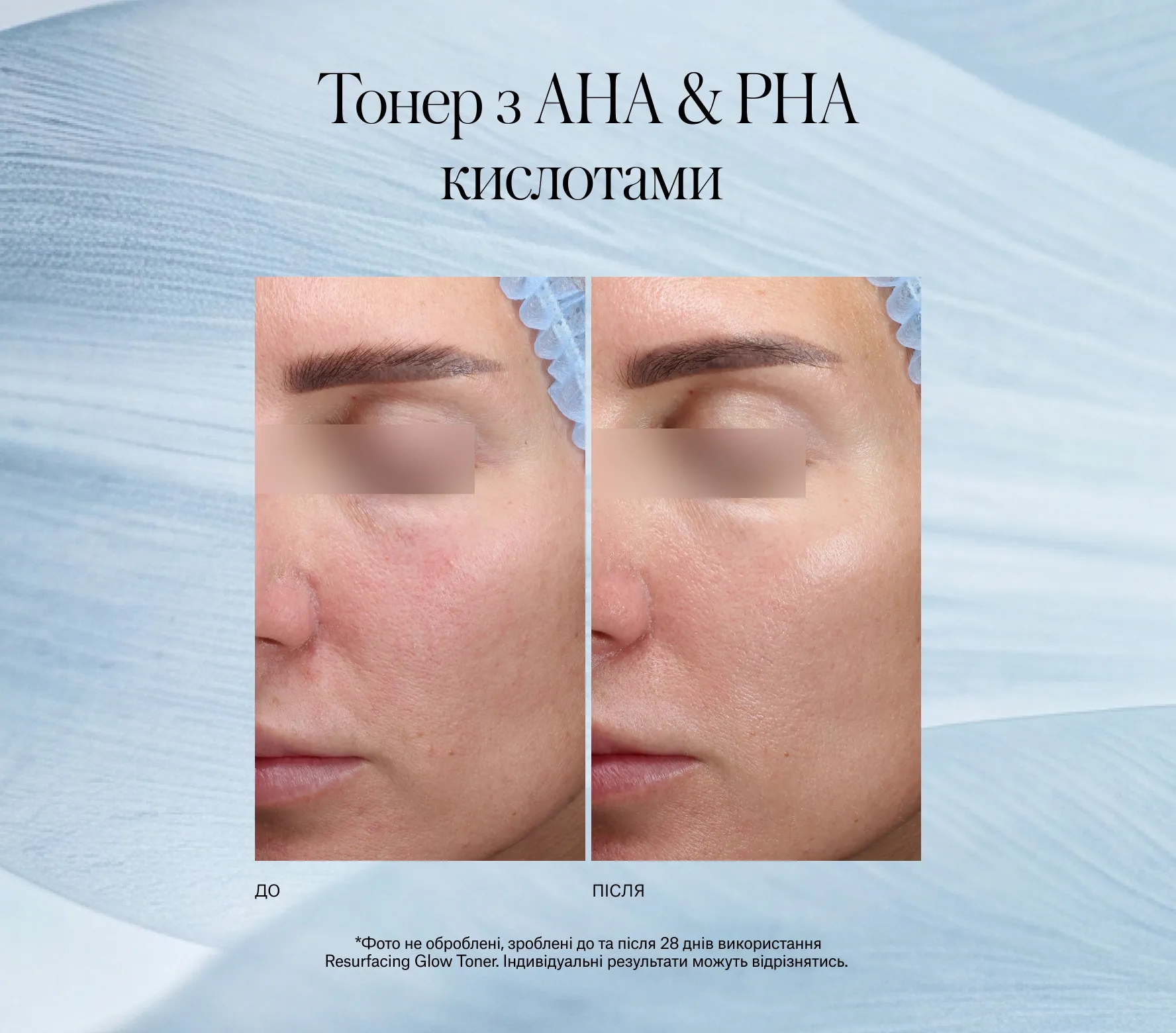 Resurfacing Glow Toner Next-Gen