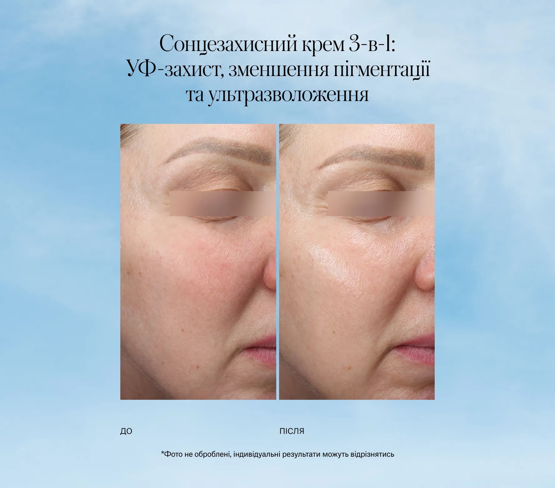 Sunscription SPF50 Next-Gen