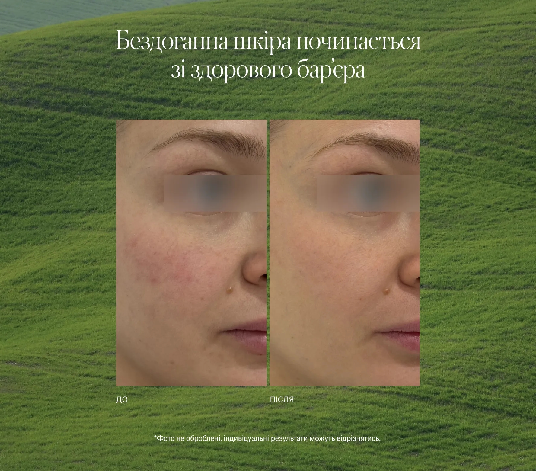 SuperBiotic Regenerating Cream Next-Gen