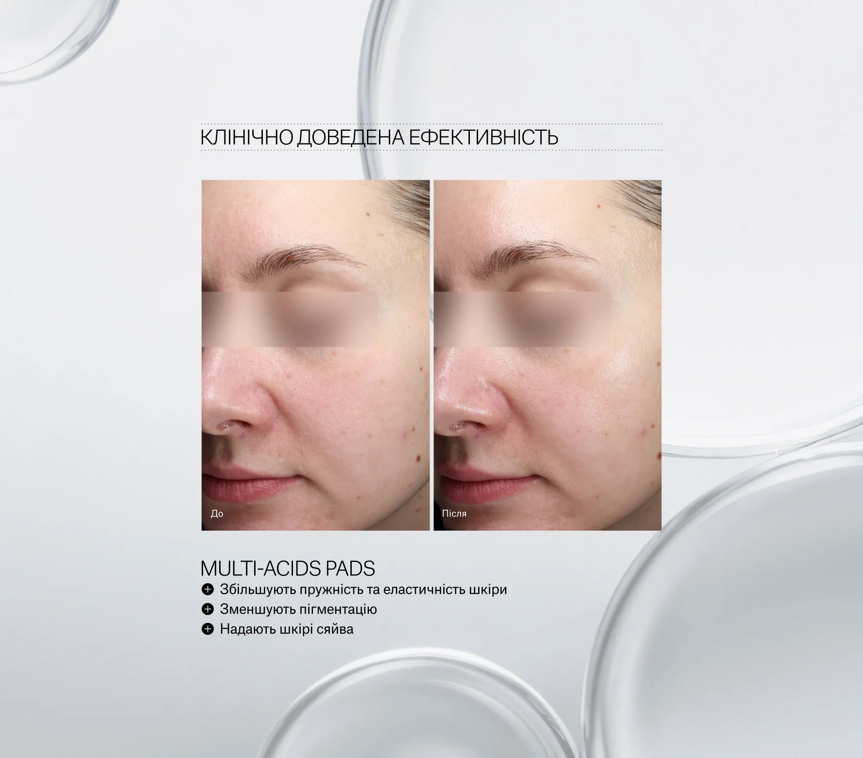Resurfacing Multi-Acids Pads Next-Gen
