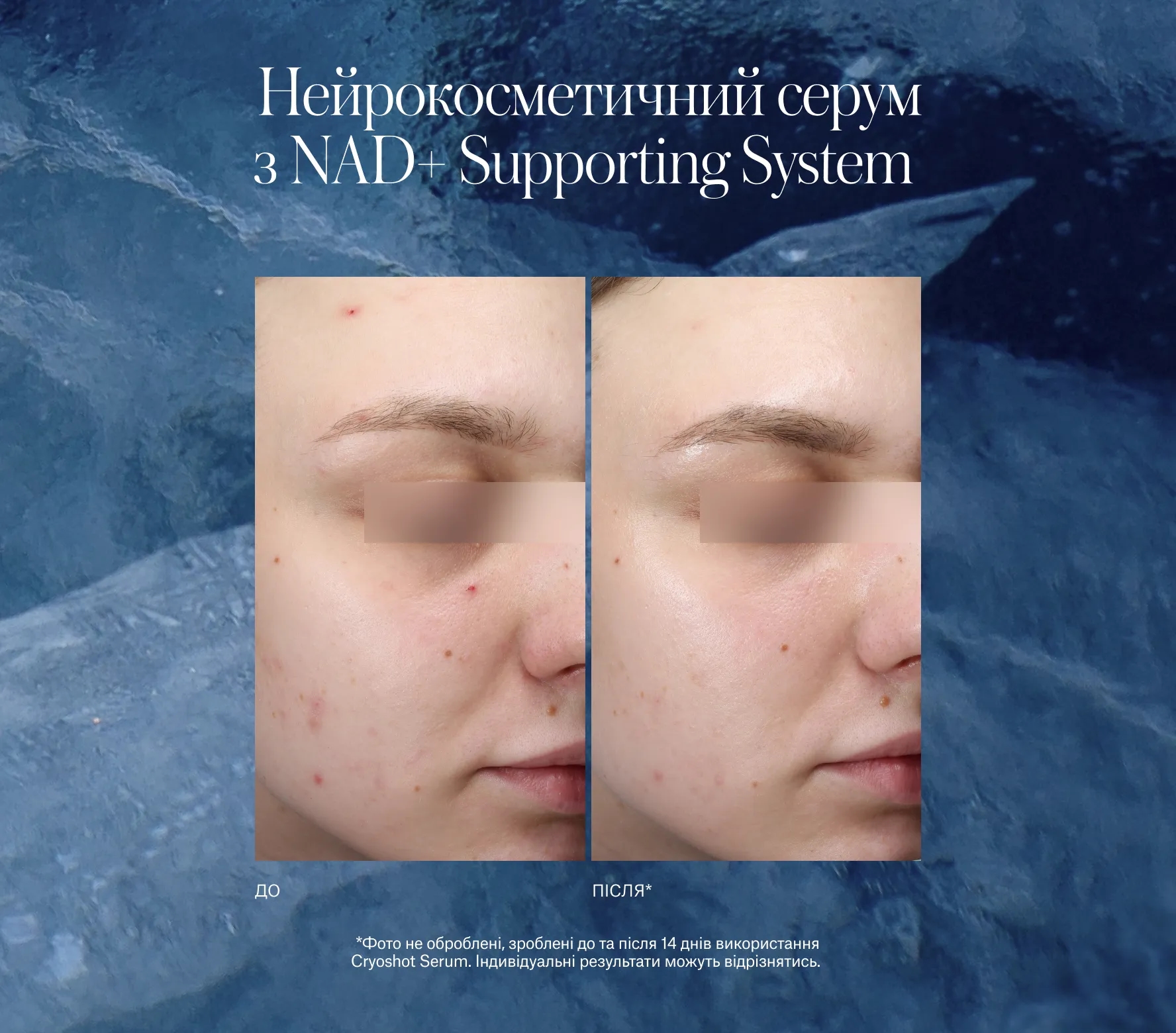 Cryoshot Hydrating Serum Classic