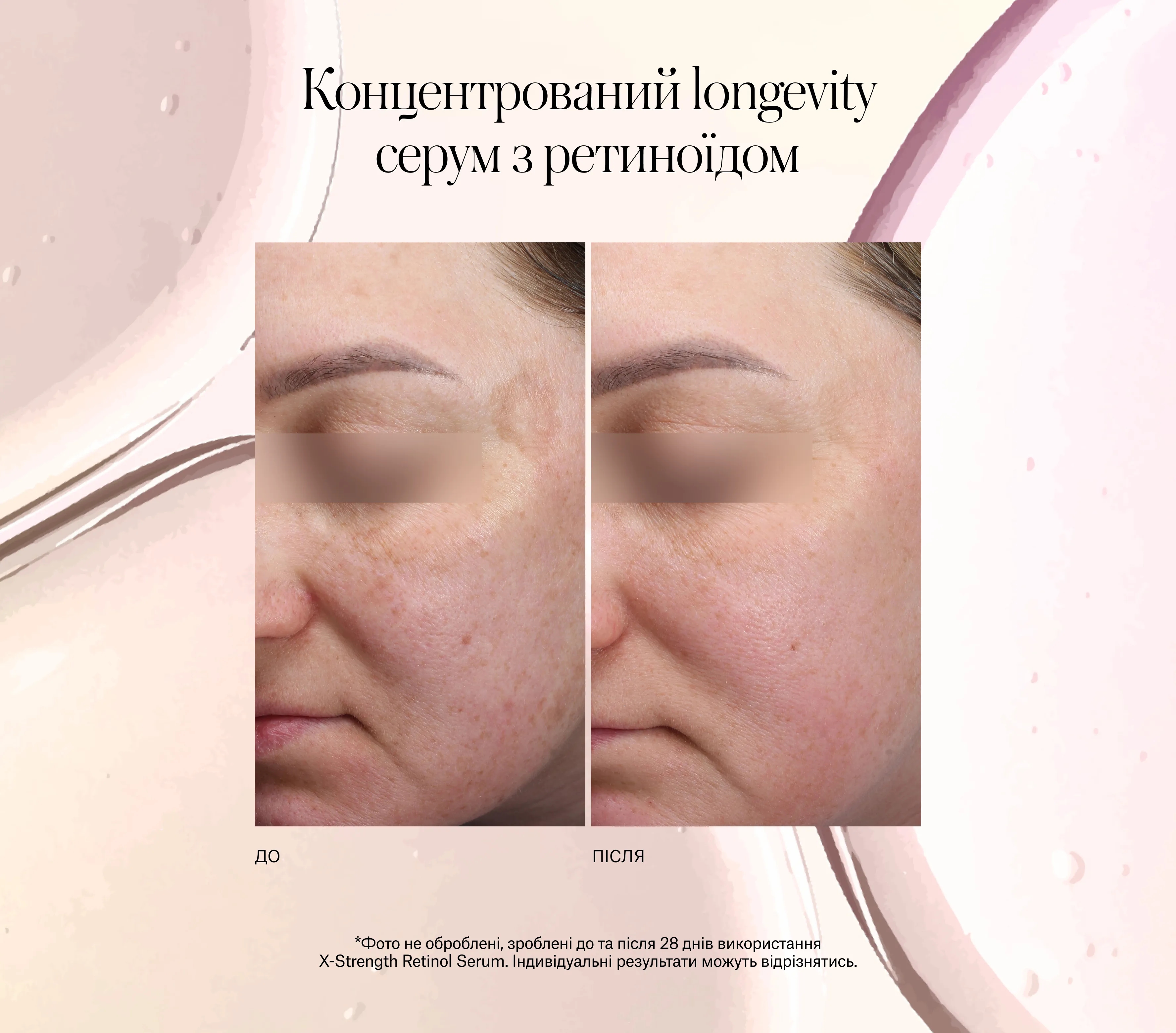 X-strength Retinol Serum Next-Gen