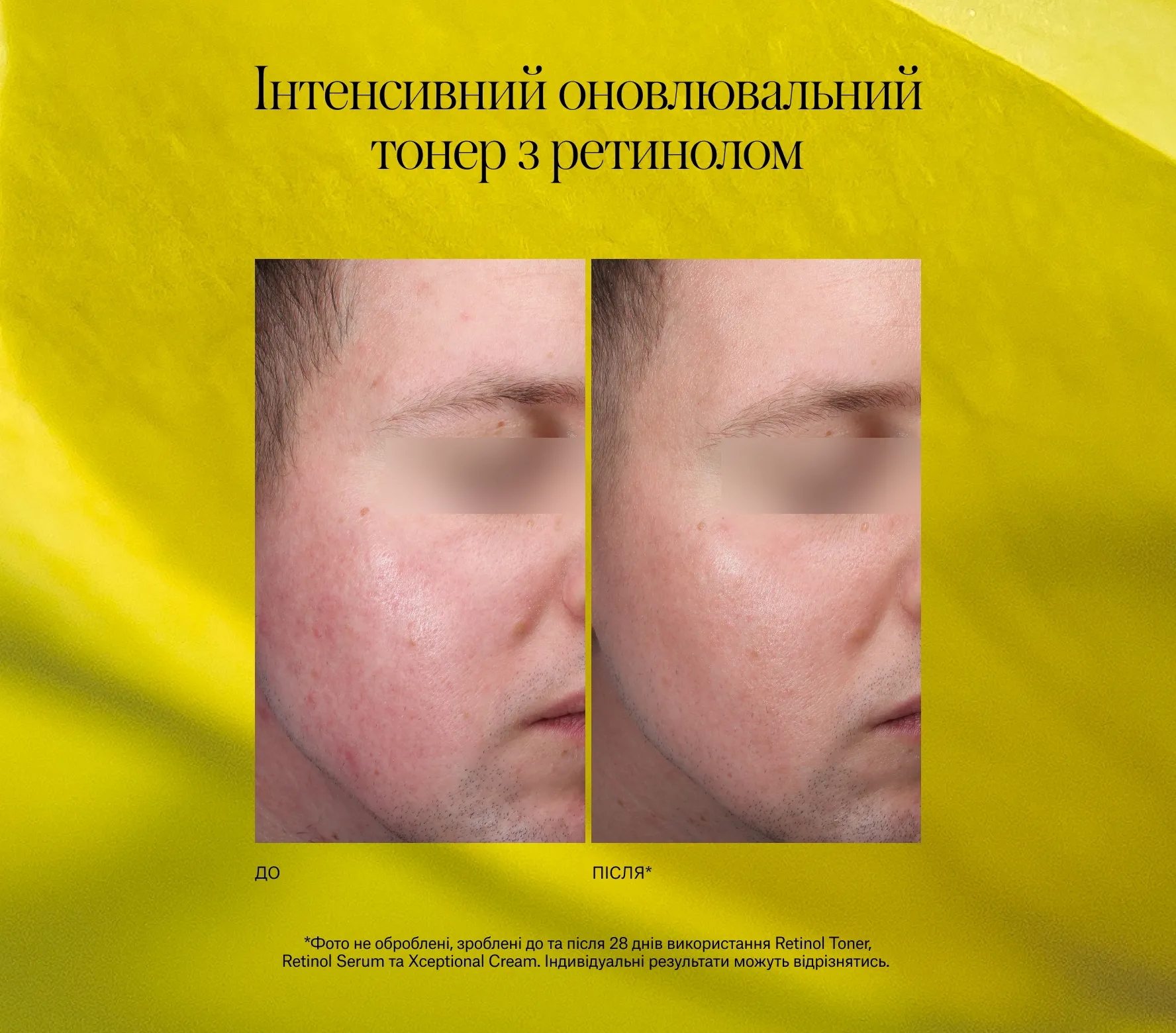 Advanced Retinol Toner Next-Gen