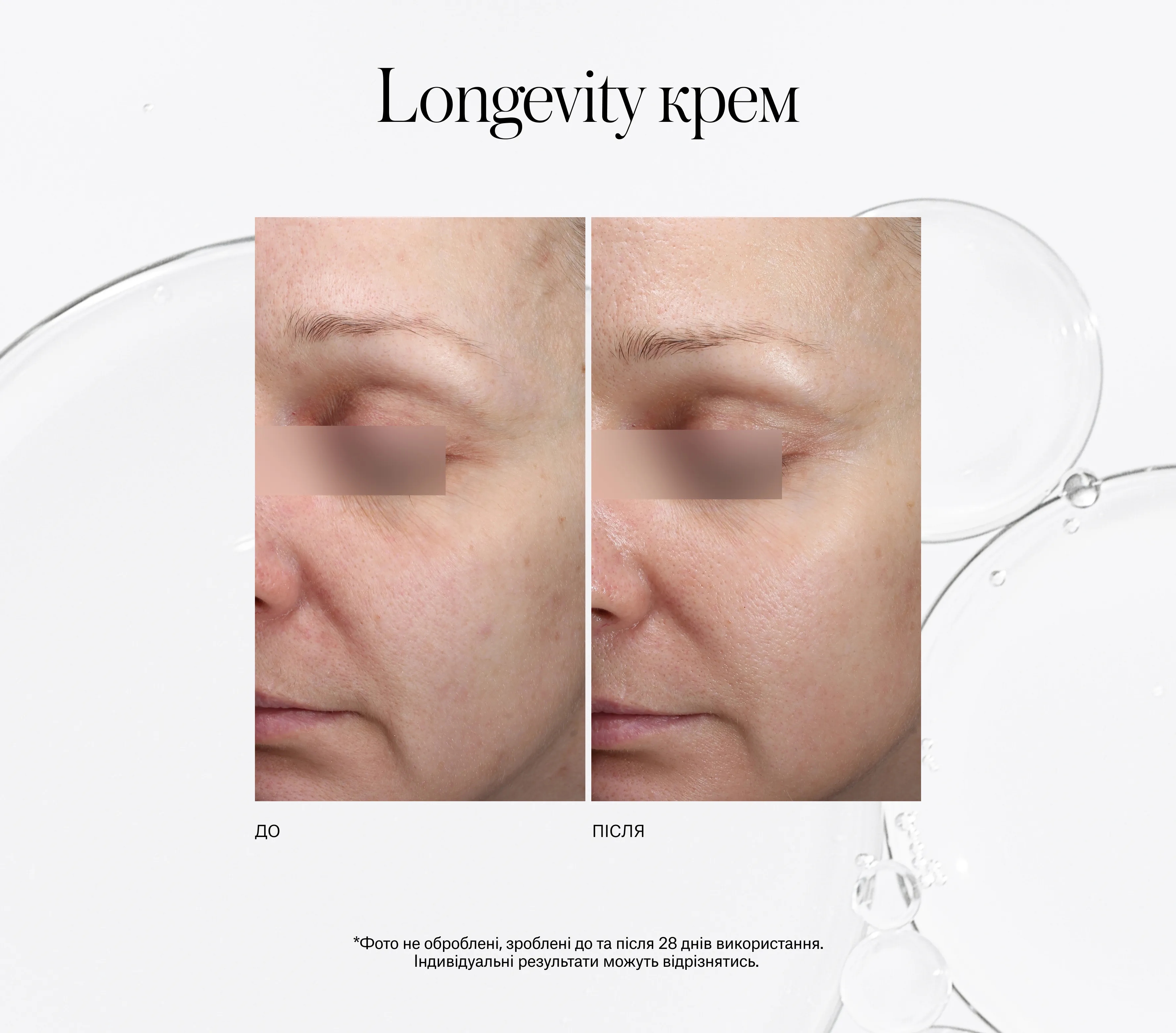 Xceptional Flawless Cream Next-Gen