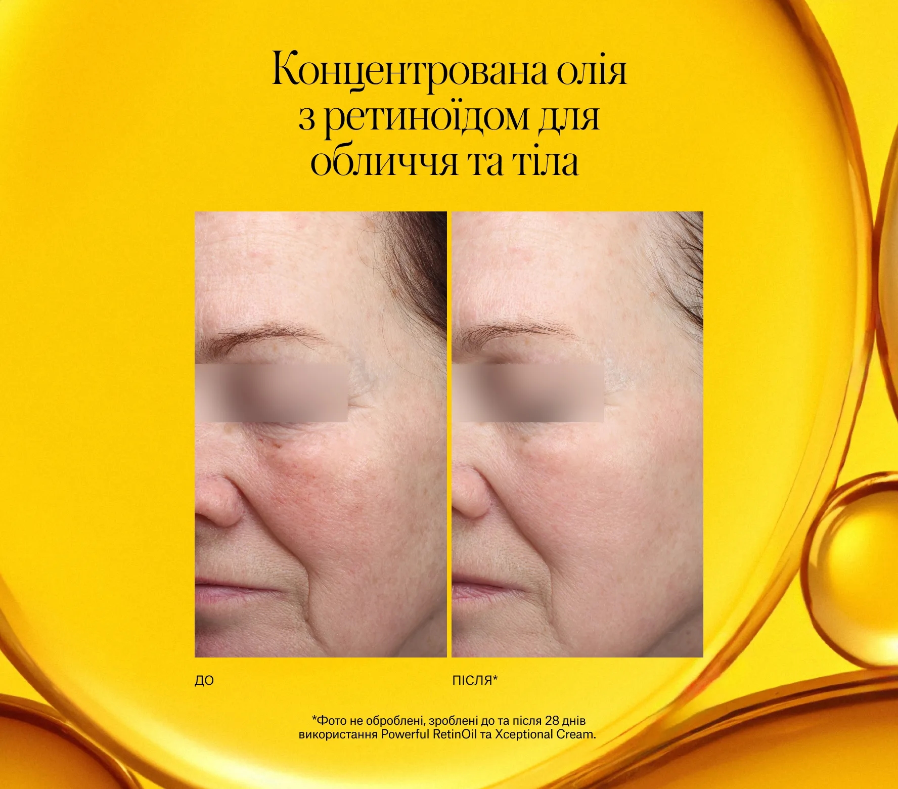 Powerful RetinOil Next-Gen