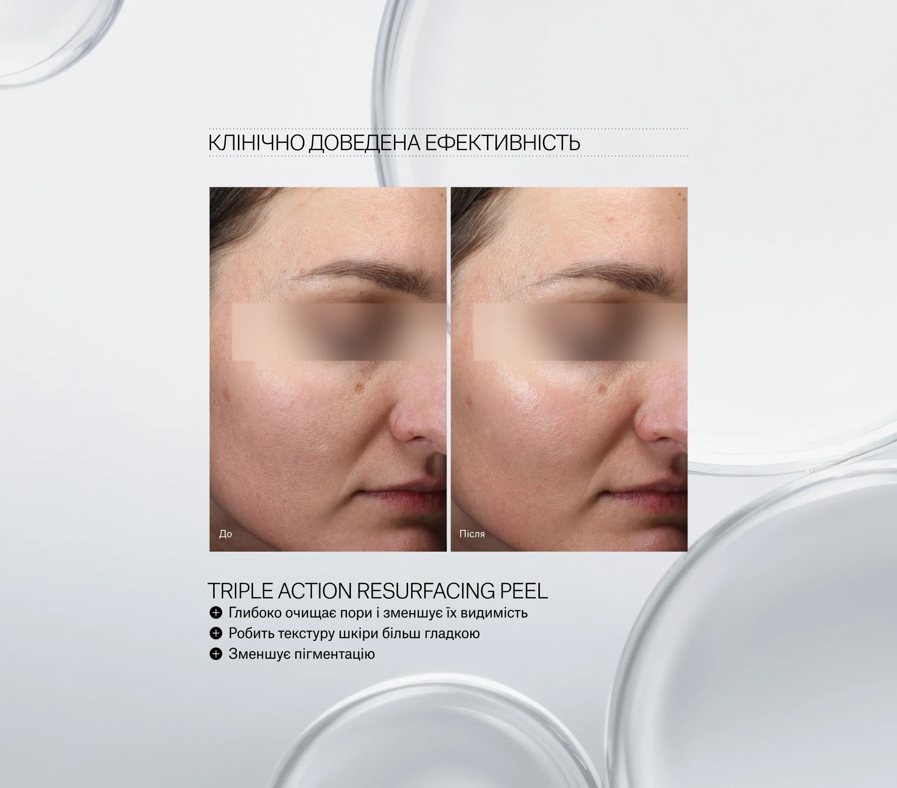 Triple Action Resurfacing Peel Next-Gen