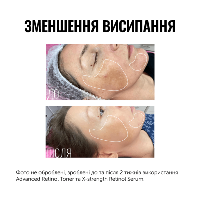 Тонер з ретинолом Advanced Retinol Toner — купити в Києві, Україні ...